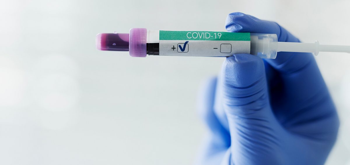 Blog NutriEffect: Coronavirus, la situazione aggiornata ad oggi 26 Marzo 2020