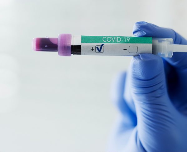 Blog NutriEffect: Coronavirus, la situazione aggiornata ad oggi 26 Marzo 2020